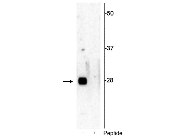 Western blot of Anti-Ribosomal protein S6 pS244 Antibody